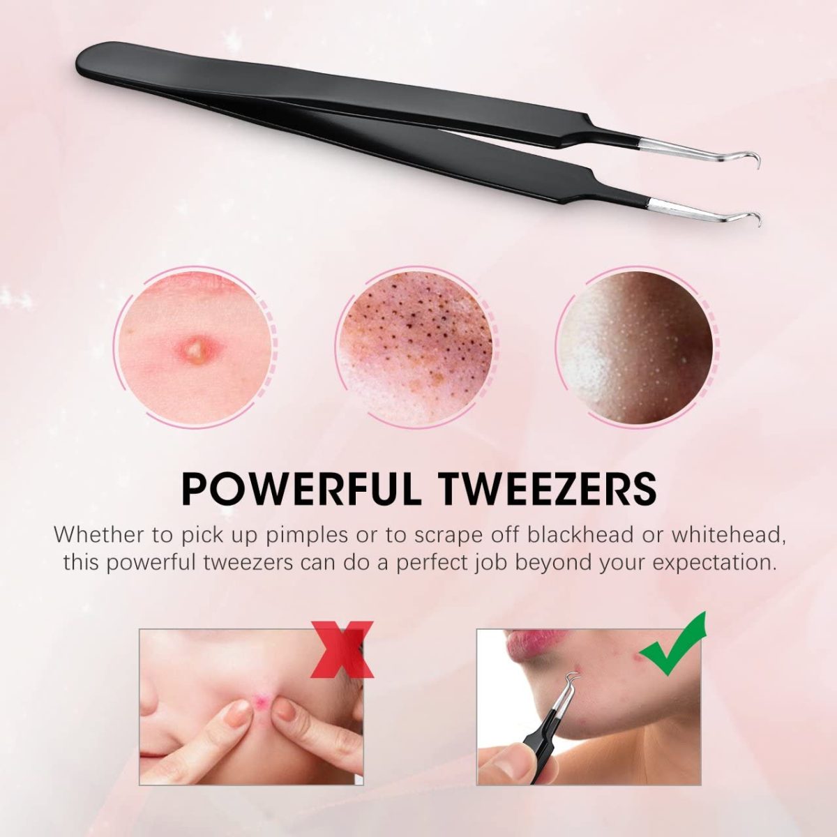 ELLESYE Blackhead Remover 6 PCS Pimple Popper Tool - Image 8